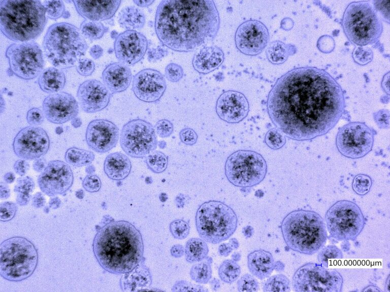 Lehrstuhl für Strömungsmechanik (LSTM)